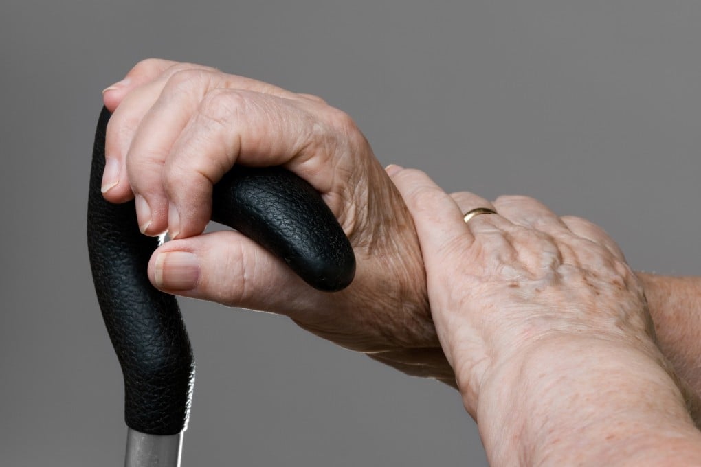 Alzheimer’s disease is commonly regarded as an age-related illness. Photo: TNS