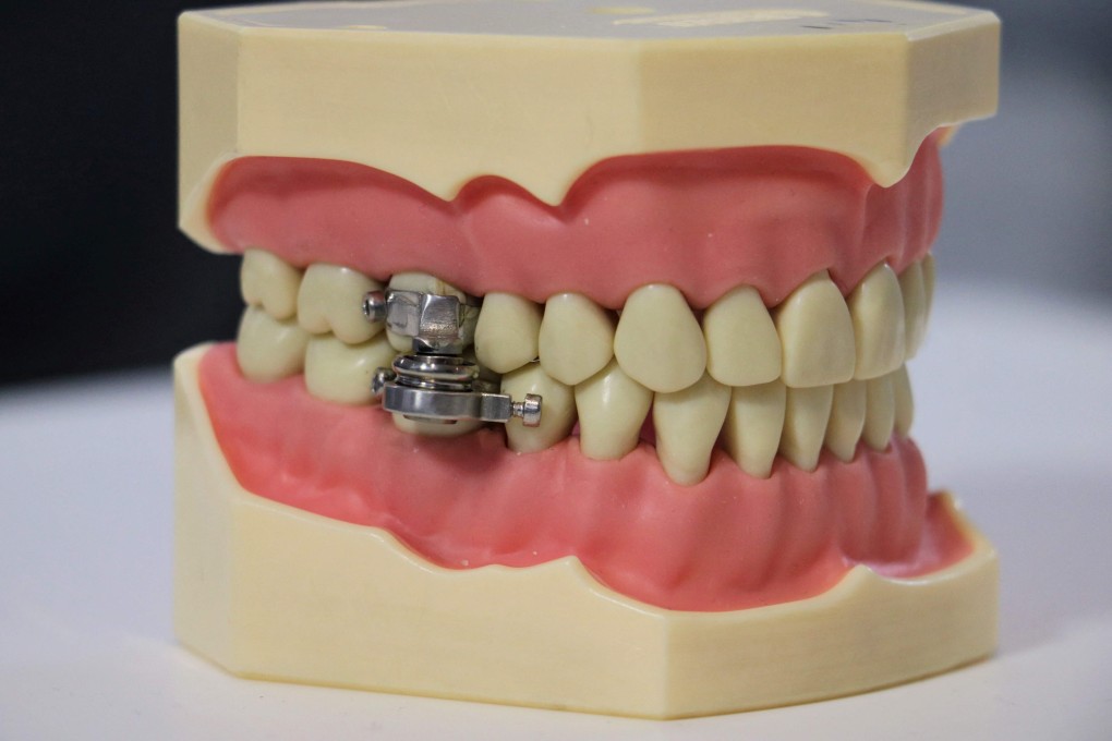 The DentalSlim has an emergency release in case the patient vomits or has a panic attack. Photo: AFP