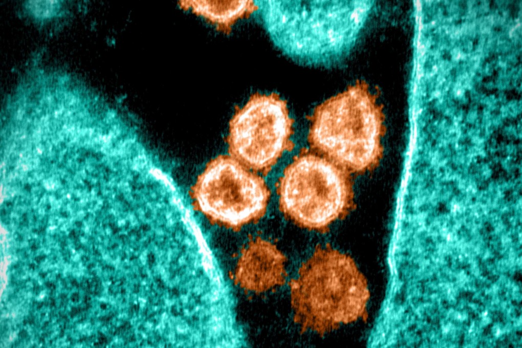 A colourised image taken by a transmission electron microscope shows Sars-CoV-2, the virus also known as 2019-nCoV that causes Covid-19. Photo: National Institute of Allergy and Diseases Handout via AFP