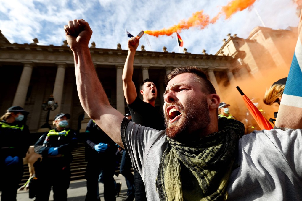 A protester shouts slogans during a rally in Melbourne on July 24, 2021. Photo: AFP