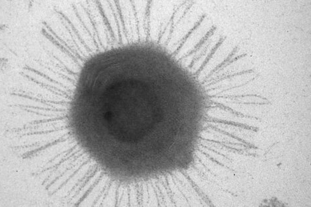 An electron micrograph of a mimivirus. Photo: Handout