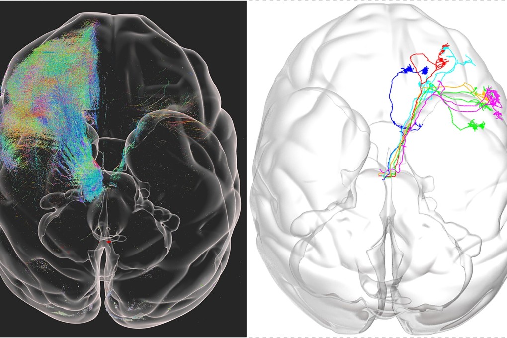 Examples of a monkey’s brain structure captured by the high-resolution image. Photo: Handout