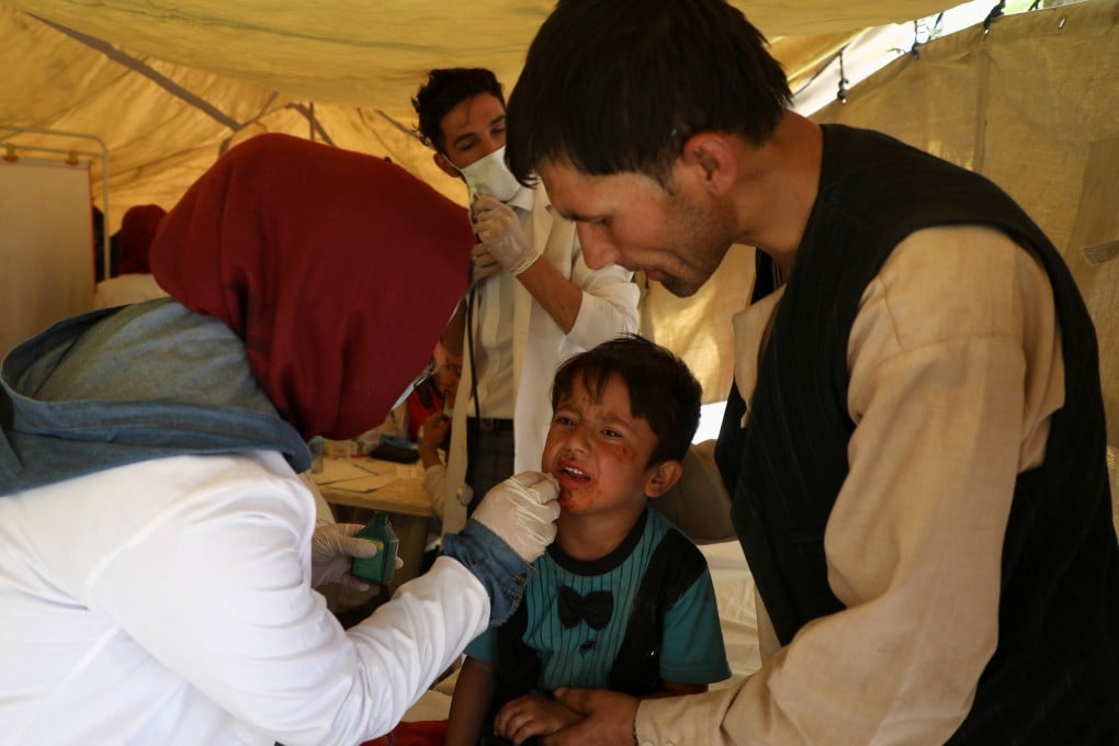 An internally displaced child from the northern provinces, who fled his home during fighting between the Taliban and Afghan security forces, receives medical treatment in Kabul on Tuesday. Photo: Reuters