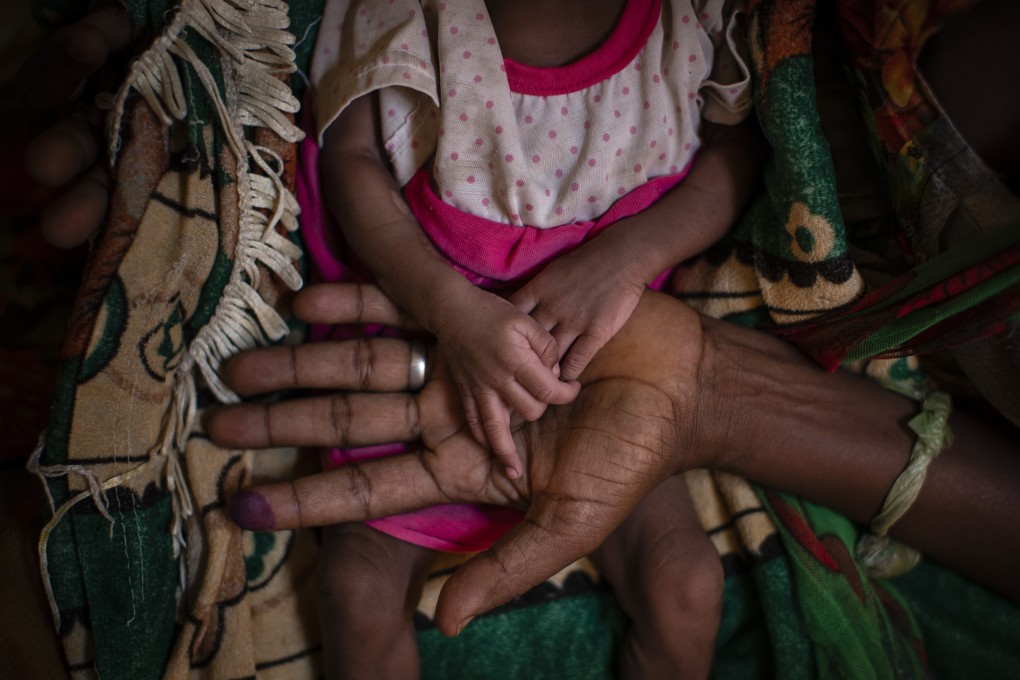 Abeba Gebru, 37, from the village of Getskimilesley, holds the hands of her malnourished daughter, Tigsti Mahderekal, 20 days old, in the treatment tent of a medical clinic in the town of Abi Adi in May. Photo: AP