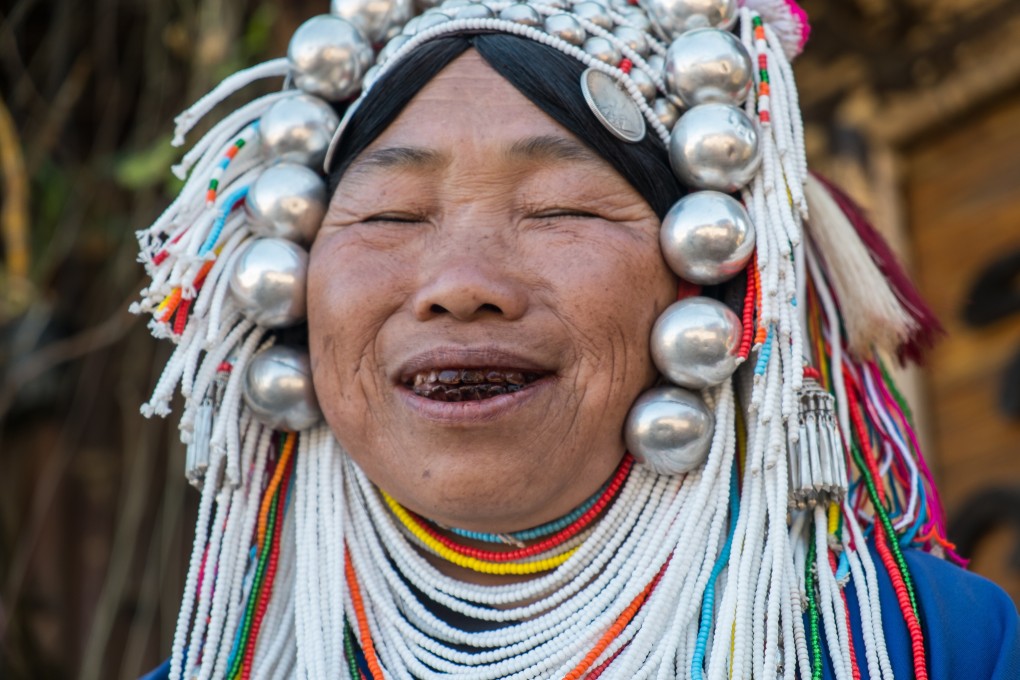 Chewing betel nuts is common across Asia. This woman from Thailand has stained teeth from long-term use. Photo: Steve Thomas
