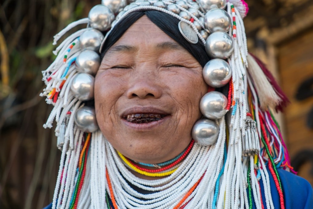 Chewing betel nuts is common across Asia. This woman from Thailand has stained teeth from long-term use. Photo: Steve Thomas