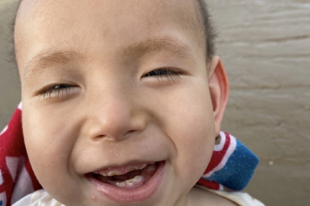 Despite having only a high-school education, a father in Kunming taught himself how to produce drugs for his son who suffers from Menkes disease. Photo: Weibo