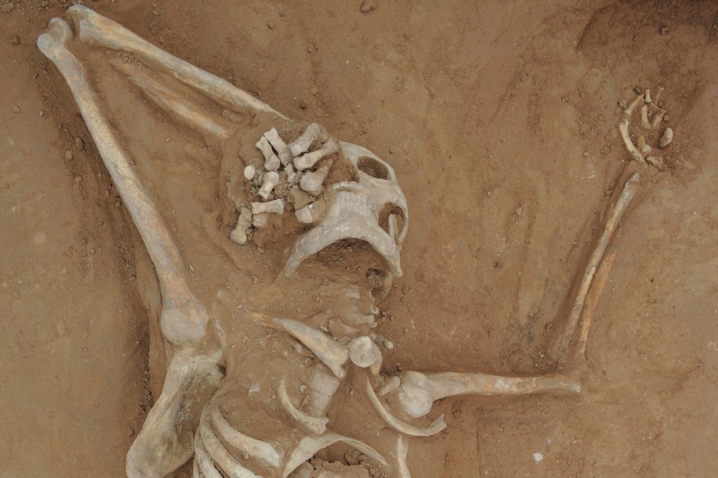 Scientists in have figured out the likely reason a man in China died 1,300 years ago. Photo credit: Qian Wang