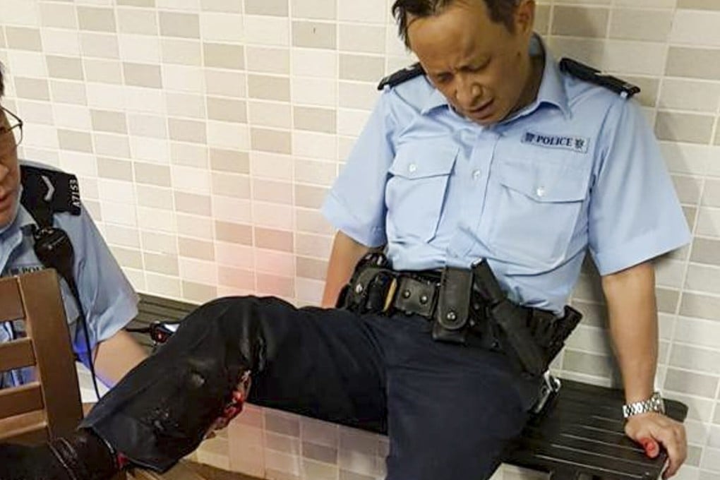 A part-time Hong Kong police officer is treated after being bitten by a wild boar in Hong Kong’s Tin Hau neighbourhood early on Wednesday morning. Photo: Facebook