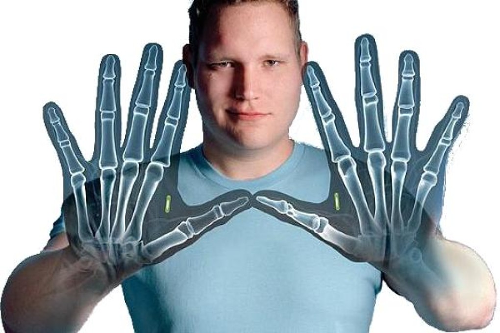 Dangerous Things claims it has sold about 10,500 chips, as well as the do-it-yourself kits to install them under the skin, to people all over the world. Photo: Dangerous Things