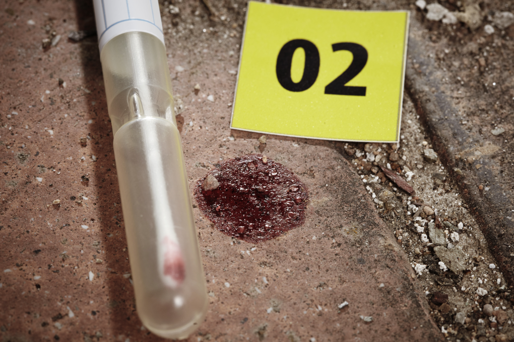 Scientists have always had to collect blood at the crime scene and transport it back to the lab for testing. Photo: Couperfield/Shutterstock