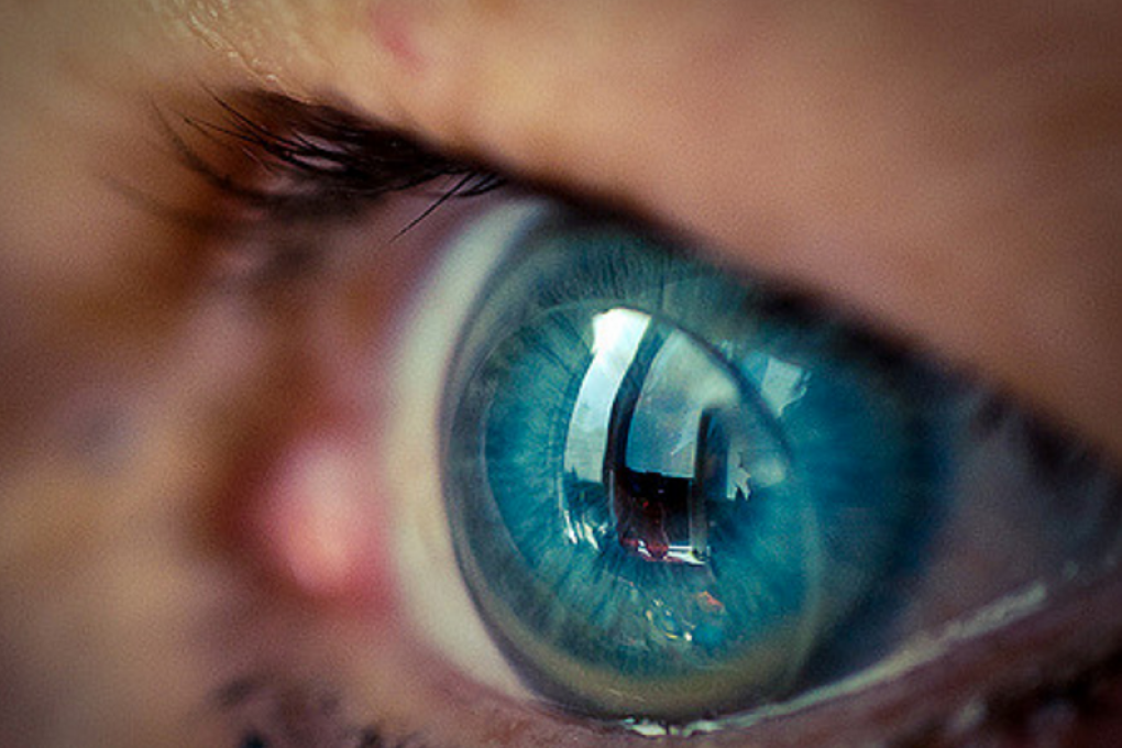 Eye diseases are becoming increasingly common, with about 34 million people being affected by either glaucoma, retinal diseases, or dry eye by 2050. Photo: Niek Beck/Flickr