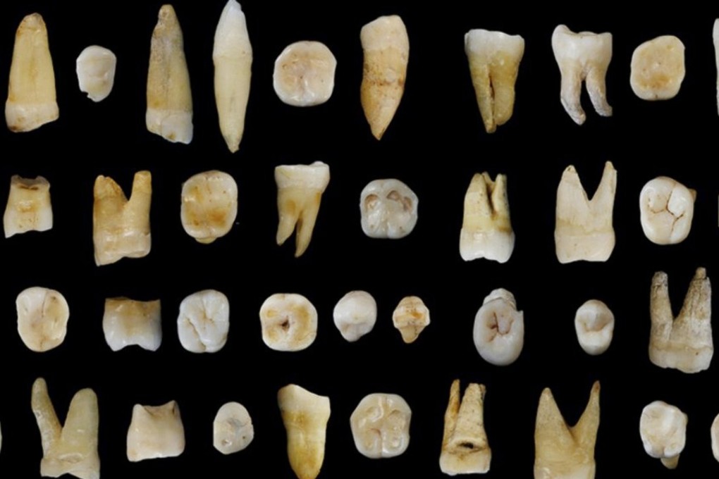 Forty-seven human teeth found in the Fuyan Cave in Hunan Province in China. Photo: Reuters