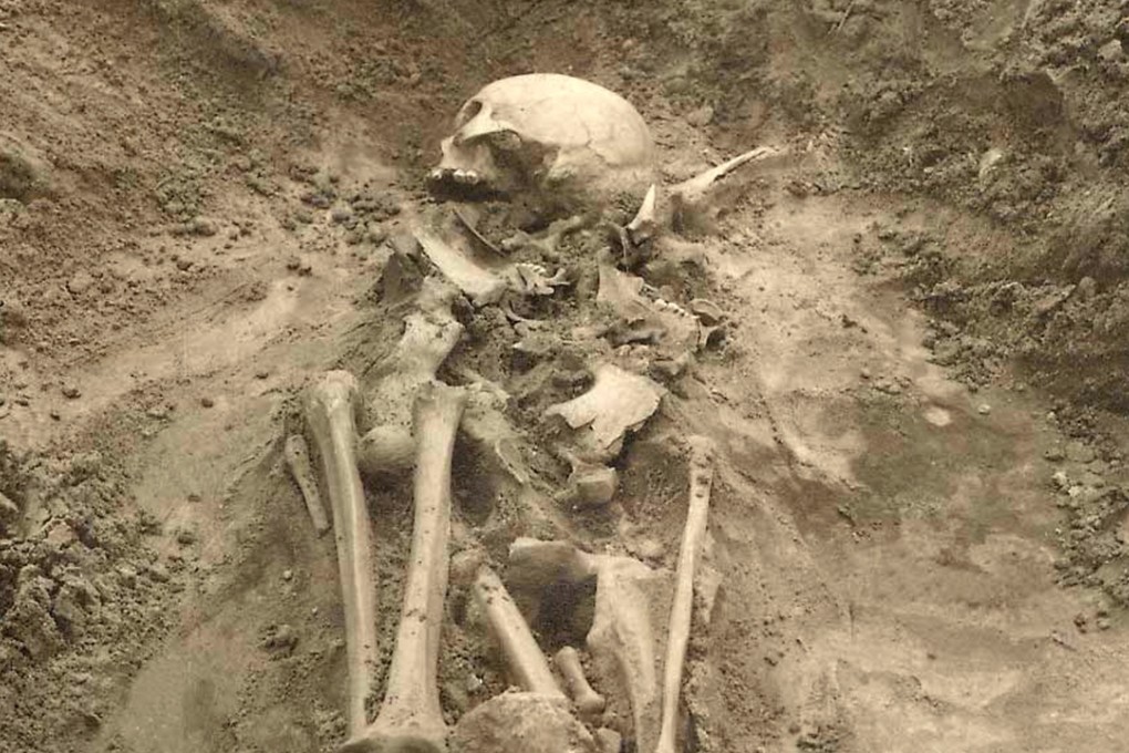 Plague DNA was found in a tooth from this individual in Estonia and is the earliest evidence of plague found in Europe. Photo: AP