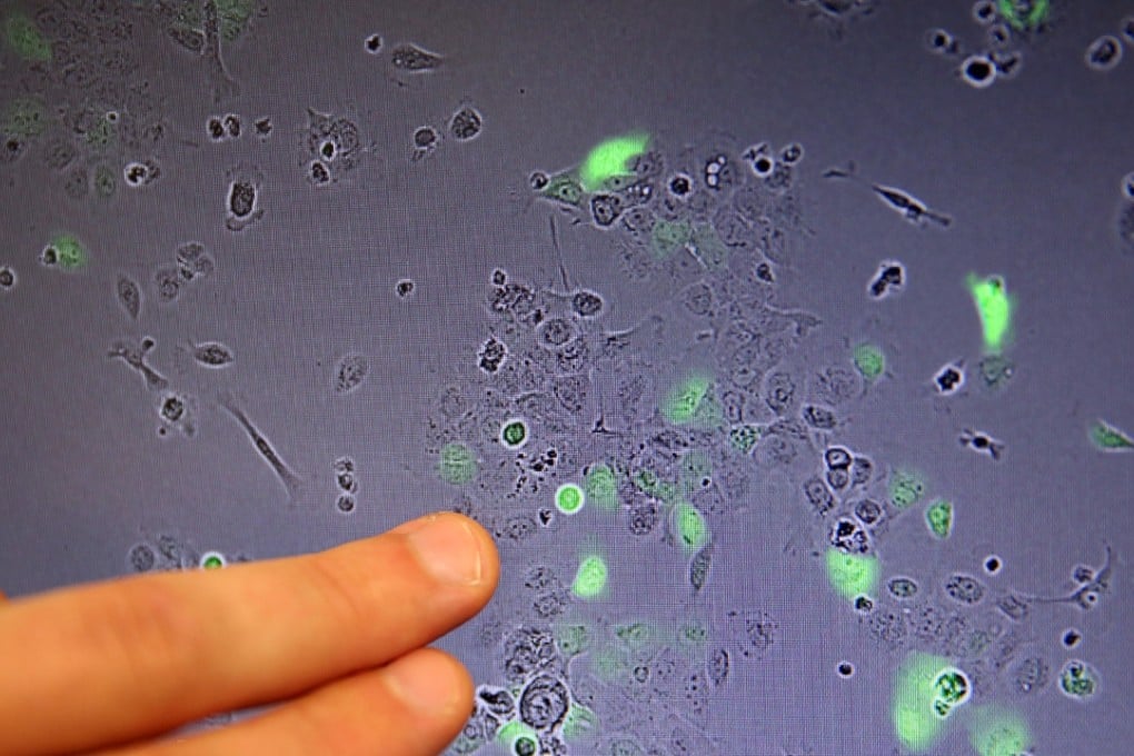 Associate scientist Stuart Sievers, Ph.D., points to a screen that displays the view from a microscope. Image: Los Angeles Times