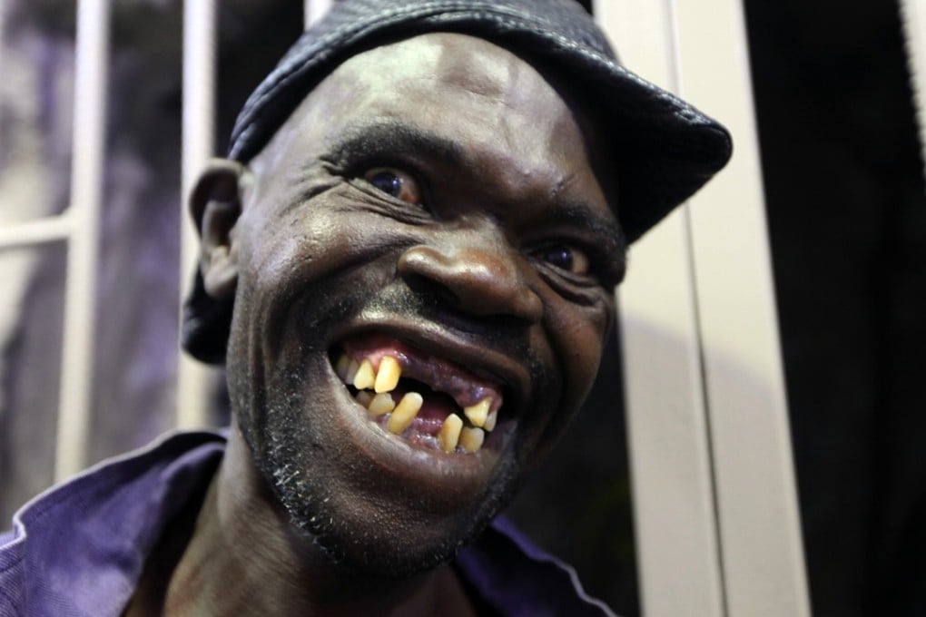 Mison Sere shares the winning smile that saw him crowned Mr Ugly 2015 in Harare on Saturday. Photo: AP