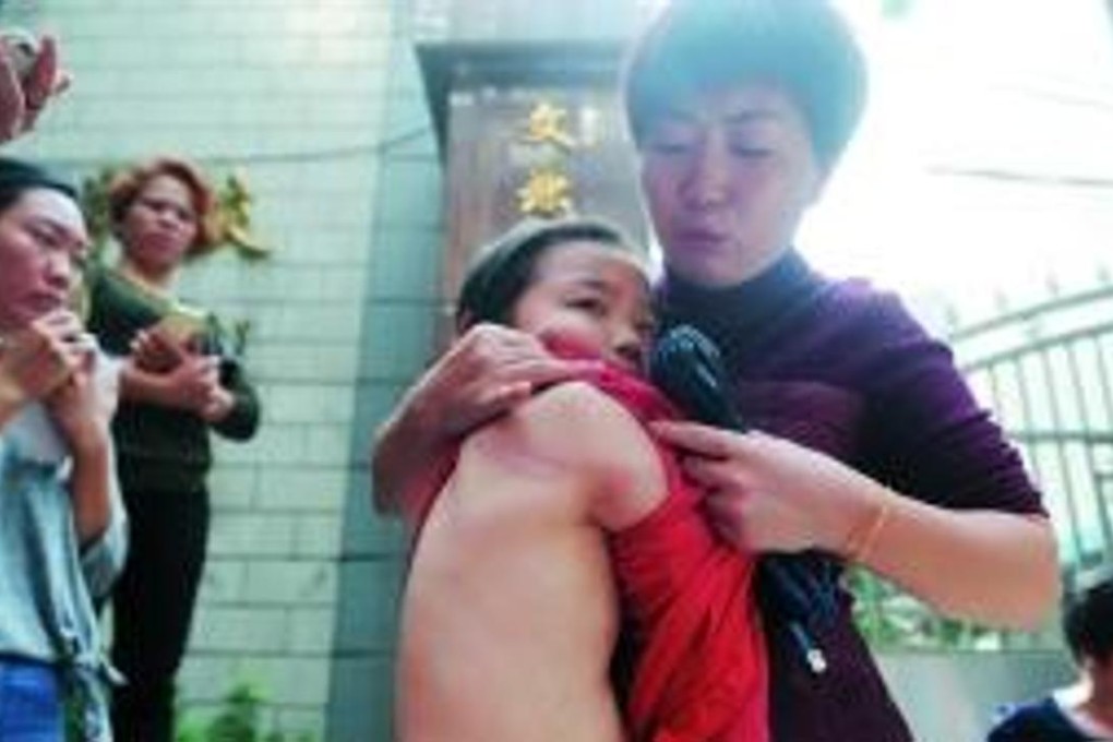 A parent shows her child’s bruise received after a teacher at a school in Guangzhou beat 16 students for disturbing his nap. Photo: News.cn