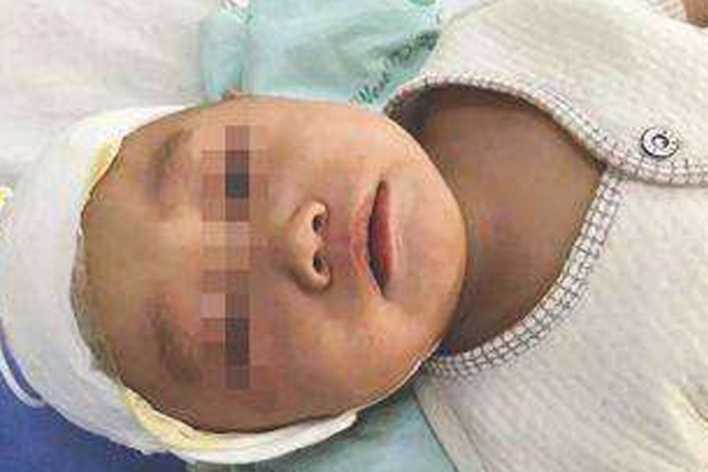 The baby underwent a four-hour operation, but was not expected to suffer permanent damage. Photo: Xinhua