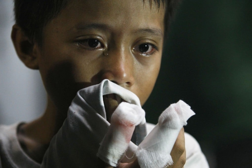 A Filipino boy cries at a hospital after being treated for a firecracker injury. Photo: AP