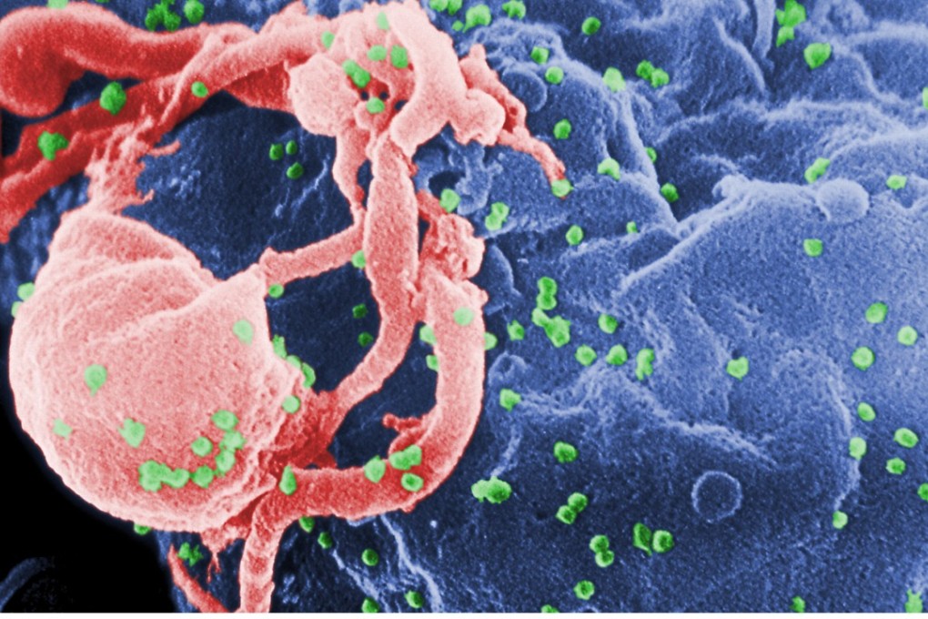 The HIV virus shown in green in this electron microscope image Photo: Centres for Disease Control and Prevention