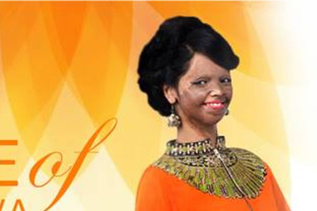 Indian acid-attack survivor becomes face of fashion brand | South China ...