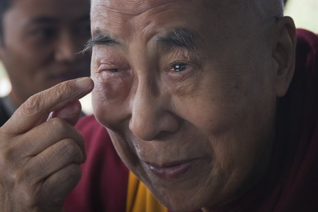 Tibetan spiritual leader the Dalai Lama points to his swollen right eye as he talks to journalists before boarding his chartered flight in Dharmsala, India. Photo: AP