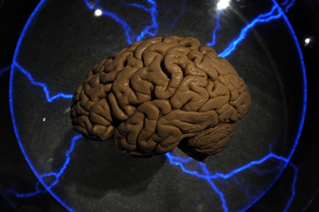 The so-called ‘folds’ in the human brain allow neurons to be packed closer together, the team found. Photo: AFP