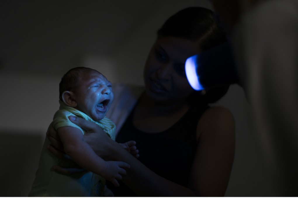Daniele Ferreira dos Santos holds her son Juan Pedro during a medical examination in North-east Brazil. Santos was never diagnosed with Zika, but she blames the virus for her son’s defect and for the terrible toll it has taken on her life. Photo: AP
