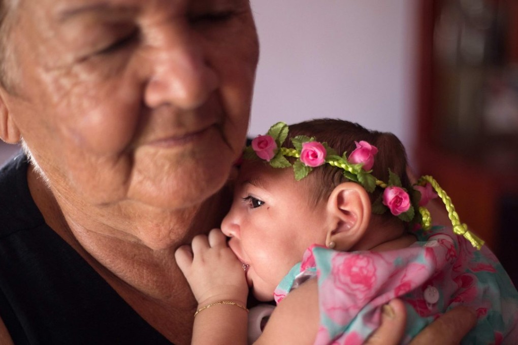 A relative cradles Ana Beatriz, a four-month-old girl with microcephaly, in Lagoa do Carro, Brazil. Photo: EPA