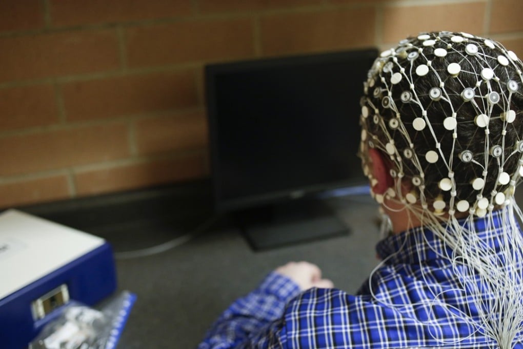 A person wears sensors used for a brain scan during a study of concussion patients. Photo: Tribune News Service o