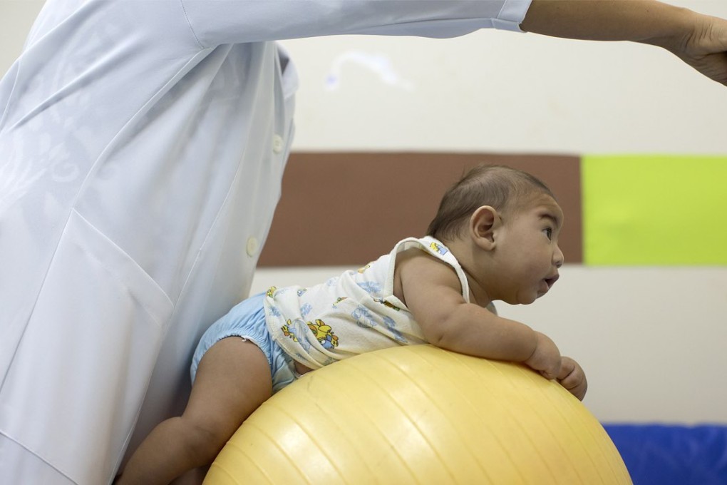 An infant who was born with microcephaly undergoes physical therapy at a therapy treatment centre in Joao Pessoa, Brazil. Photo: AP