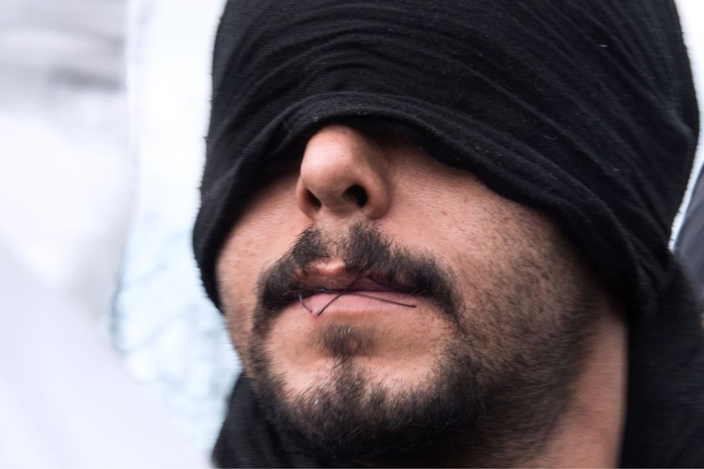 An Iranian migrant with his lips sewn together demonstrates during the demolition of the southern part of the so-called "Jungle" migrant camp in Calais on Wednesday. Photo: AFP