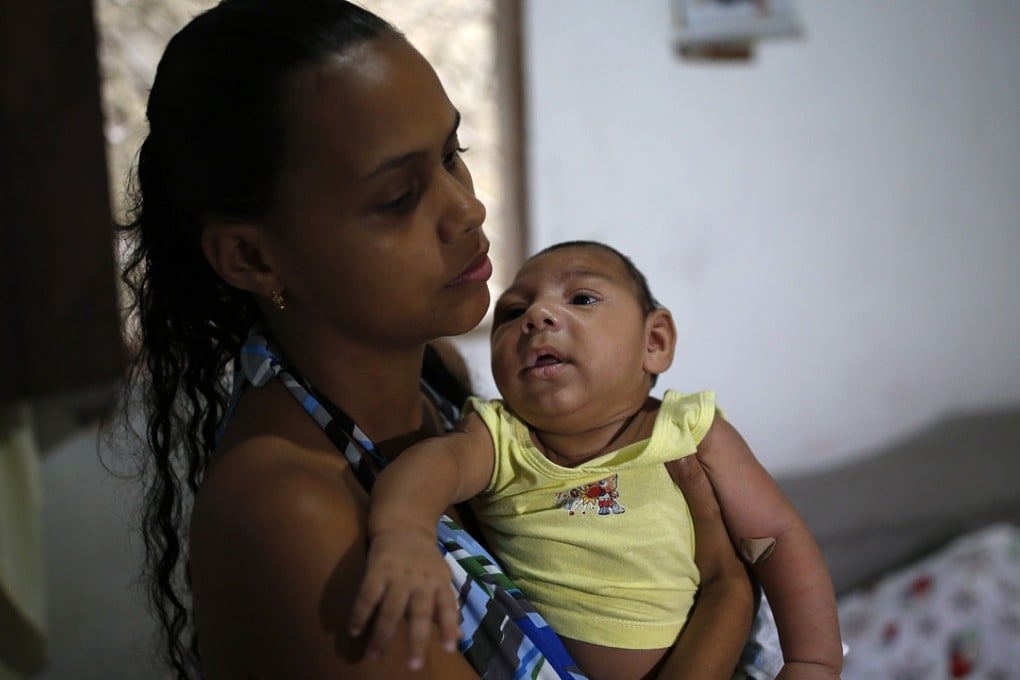 Janine Santos holds her three-month-old son Shayde Henrique, who was born with microcephaly, in Joao Pessoa, Brazil. Photo: AP