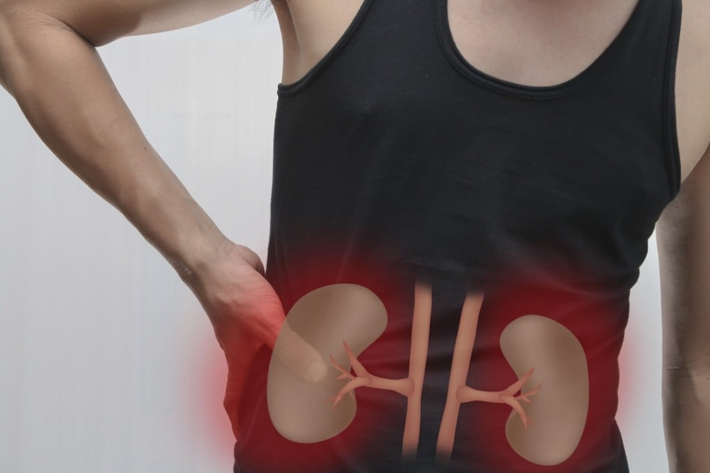 Left undiagnosed and untreated, kidney disease can lead to potentially lethal heart disorders.