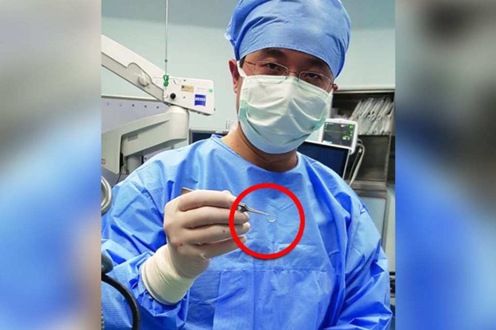 A surgeon with the cornea used in the transplant. Photo: Sina.com
