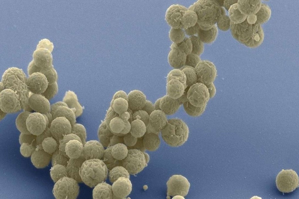 This photo provided by National Centre for Imaging and Microscopy Research at the University of California at San Diego shows electron micrographs of clusters of JCVI-Syn 3.0 cells magnified about 15,000 times. Photo: AP