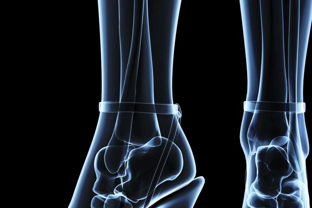 High heels may be fashionable, but they’re not healthy for the human feet.