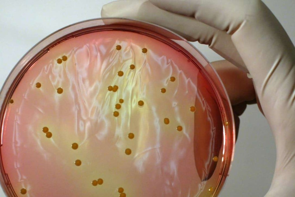 A staphylococcus culture in a laboratory at Hong Kong Polytechnic Universtiy.