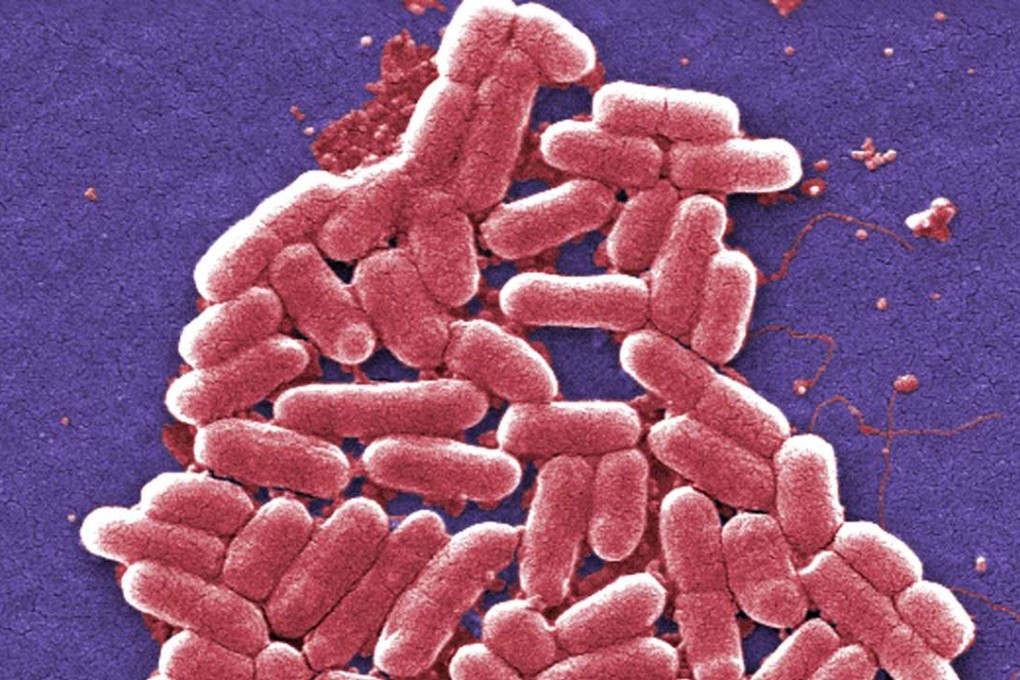 This colorised scanning electron micrograph image made available by the Centres for Disease Control and Prevention shows a strain of the E. coli bacteria. Photo: AP