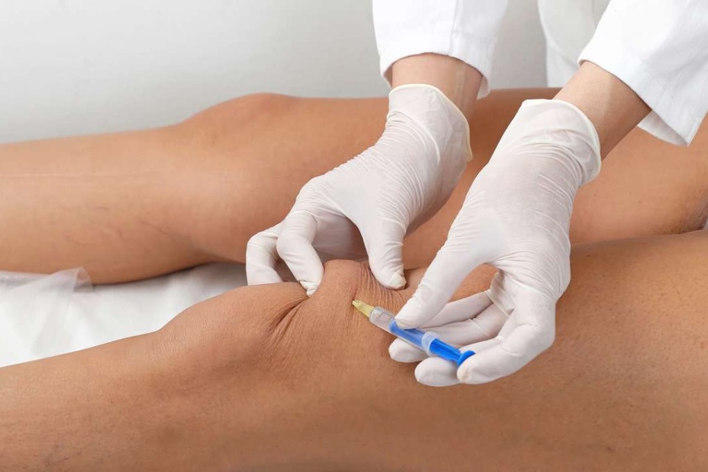 There have been three recent cases involving Botox injections. Photo: Shutterstock