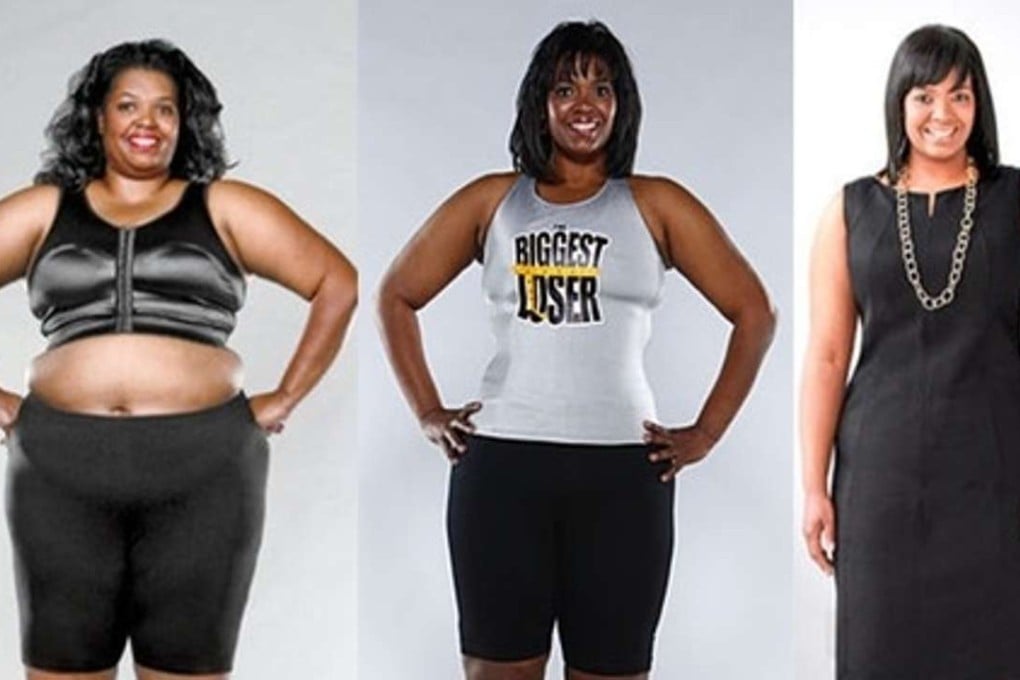 Joelle Gwynn, a former contestant on “The Biggest Loser”, said an assistant to one of the show’s trainers gave her an unknown yellow-and-black medication. Photo: NBC