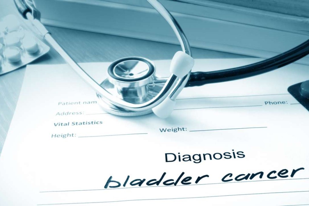 A diagnosis illustration. Photo: TNS