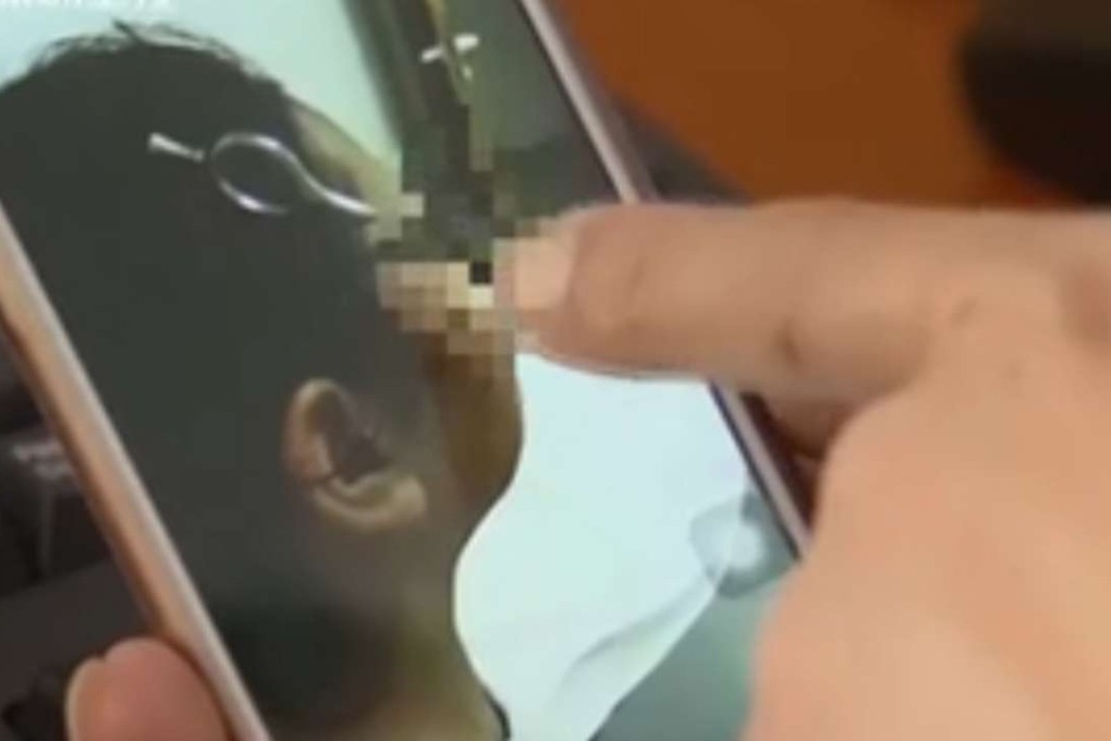 One of the Shanghai doctors shows a photograph on his phone taken of the girl before the operation, with the tips of scissors still embedded in her brain. Photo: SCMP Pictures