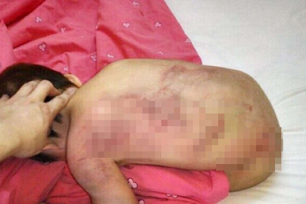 Police say the injured baby girl is in a stable condition in hospital. Photo: 163.com