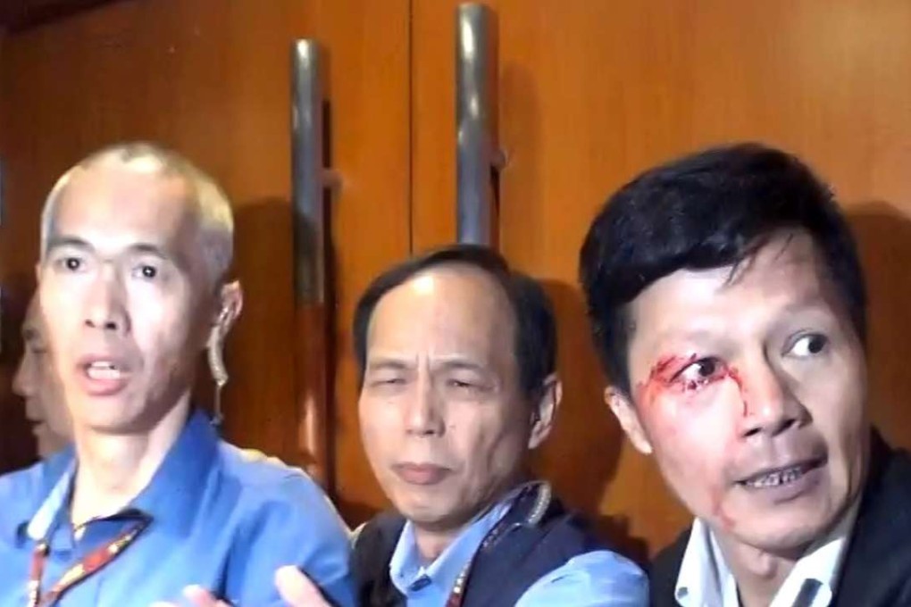 A security guard was injured during clashes with students at Chinese University. Photos: SCMP Pictures