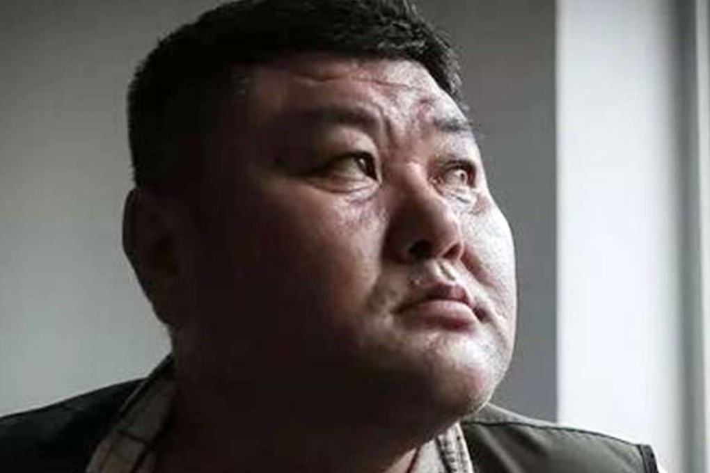 Li Gang joined the state-run sports training programme as a teenager in 1985, but is now struggling to make a living. Photo: SCMP Pictures