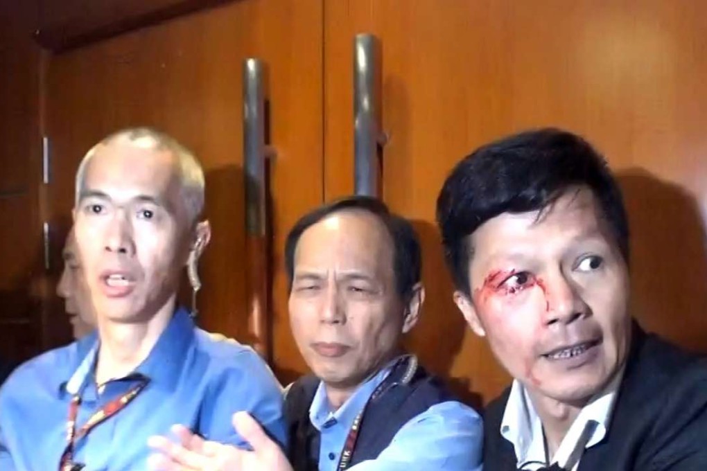 A security guard was injured during clashes with students at Chinese University. Photos: SCMP Pictures