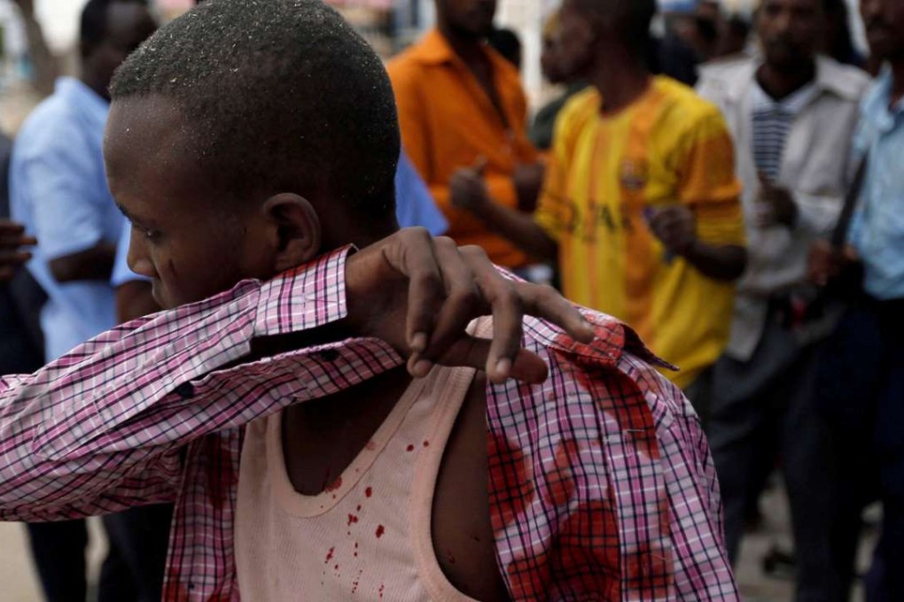 An injured man walks from the scene of a suicide bomb attack outside Naasa Hablood hotel in Mogadishu. Photo: Reuters