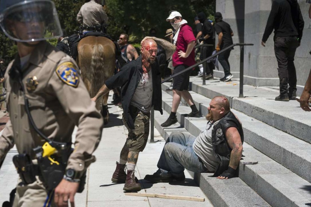 Two wounded men sit on the steps of the California state Capitol in Sacramento after clashes between right-wing extremists and counter-protesters in Sacramento, California, on Sunday. Photo: AP