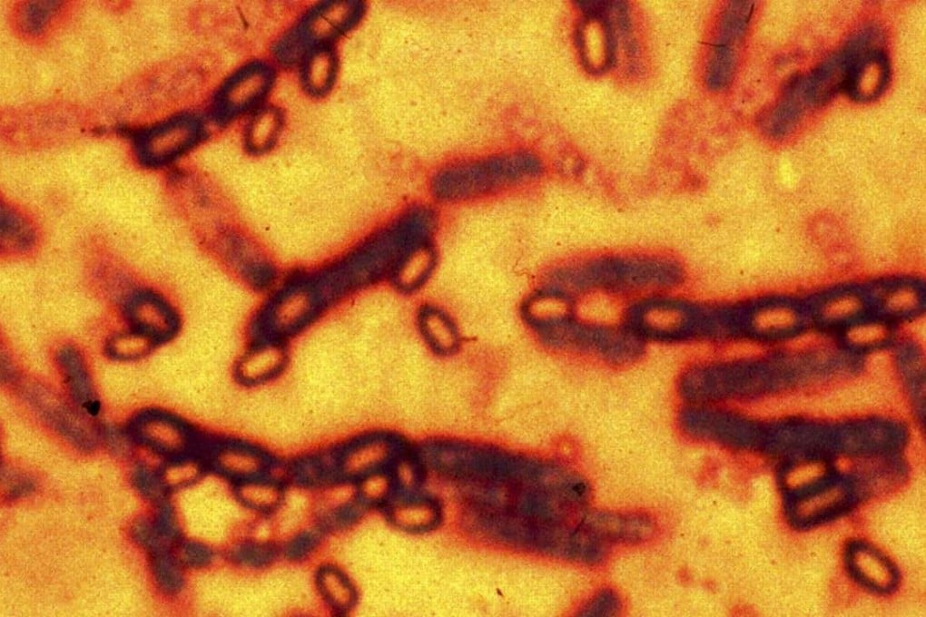 A microscopic picture of spores and vegetative cells of Bacillus anthracis which causes the disease anthrax. The bacteria was at the centre of a major scare last year when live spores were mistakenly sent around the world by a US Army lab. Photo Reuters